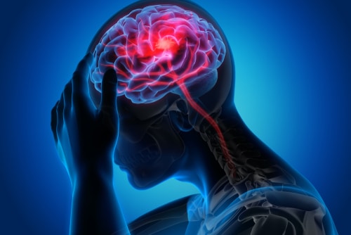 Long Island Abogado de Lesiones Cerebrales | The Matera Law Firm